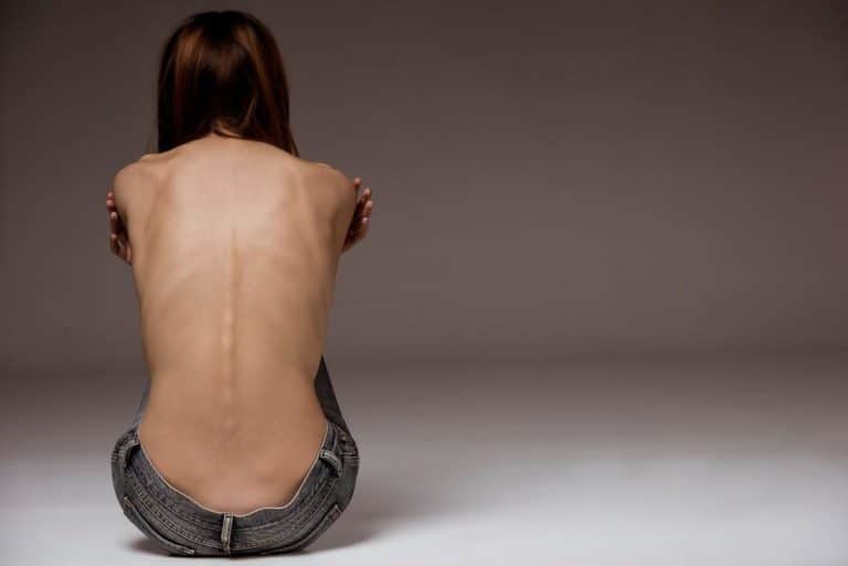 L&rsquo;anorexie, serait-ce une nouvelle addiction ?
